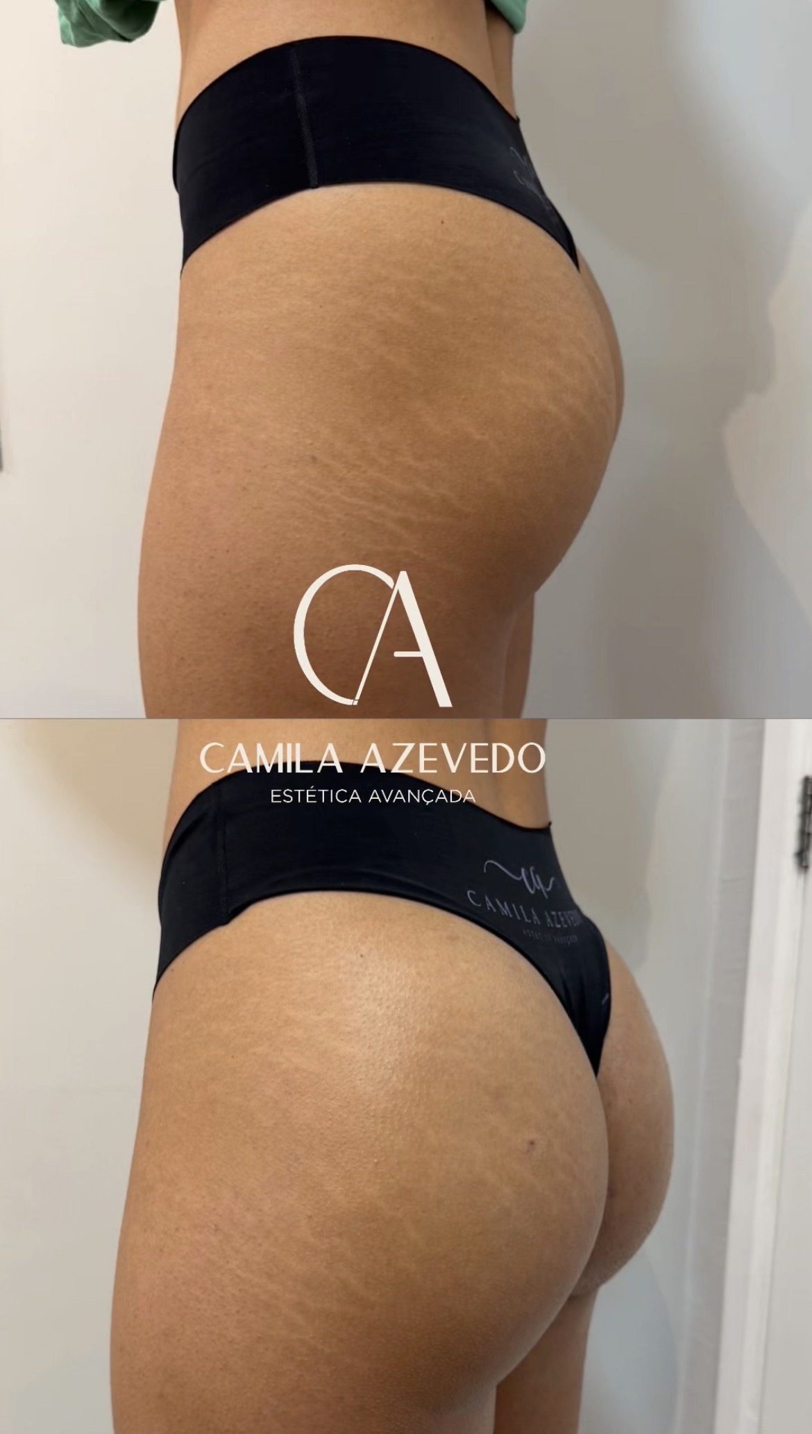 Resultado MaxxBum 2