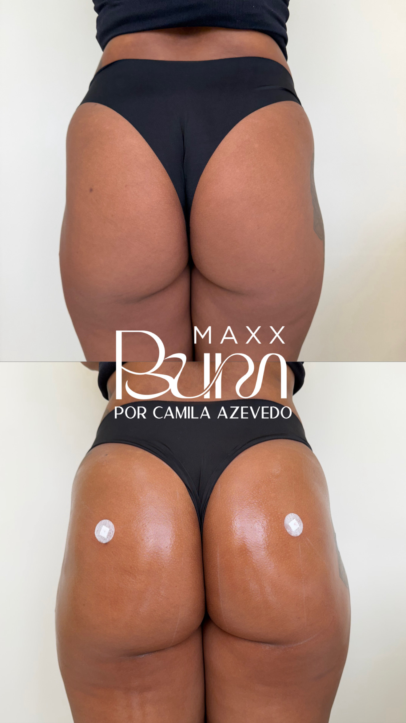 Resultado MaxxBum 1